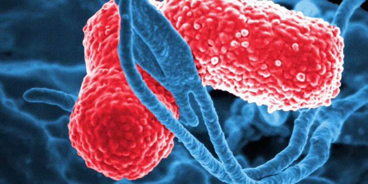 Emite Secretaría de Salud alerta epidemiológica por ‘Klebsiella oxytoca’